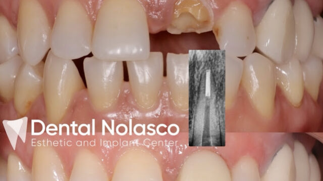 Dental Nolasco Esthetic and implant center