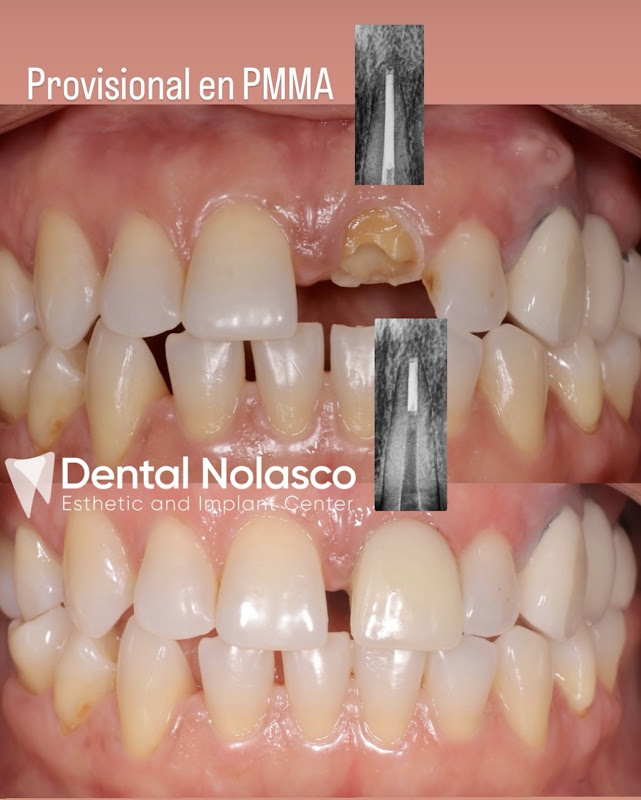 Dental Nolasco Esthetic and implant center