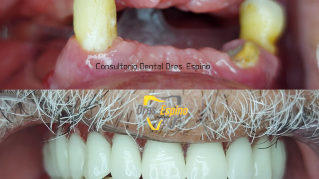 OdontoEspino Consultorio Dental
