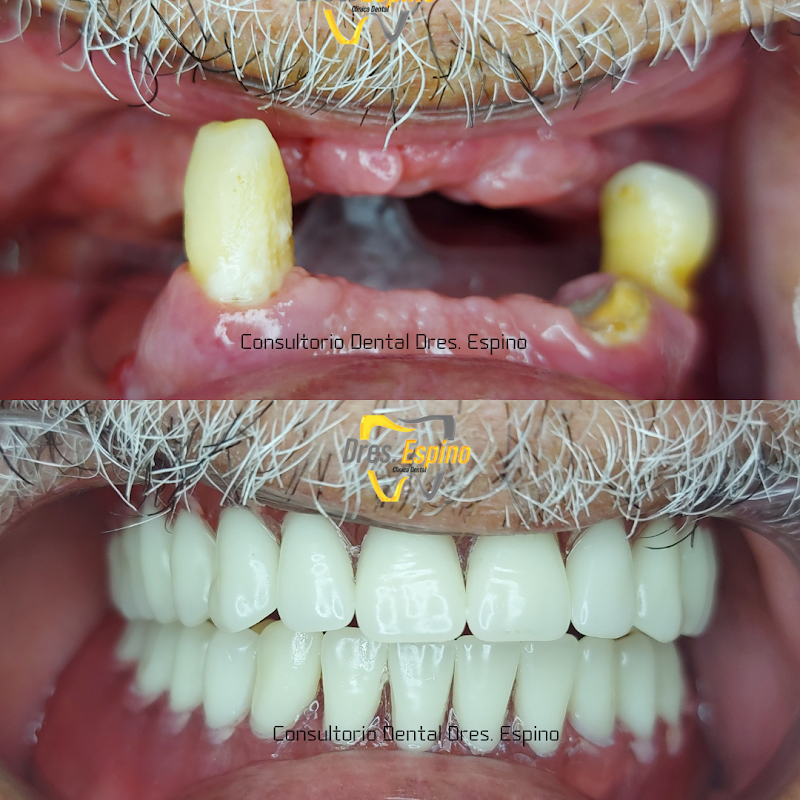 OdontoEspino Consultorio Dental