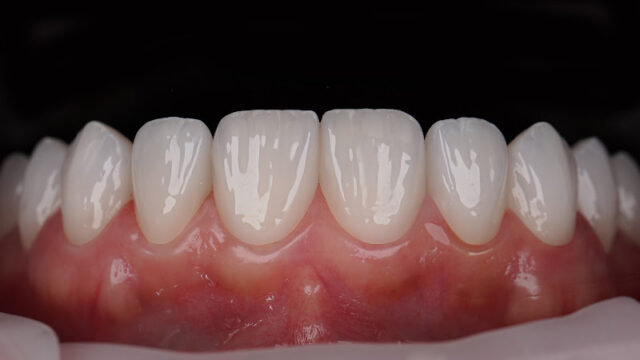 Perfect Smile Experience Punta Cana