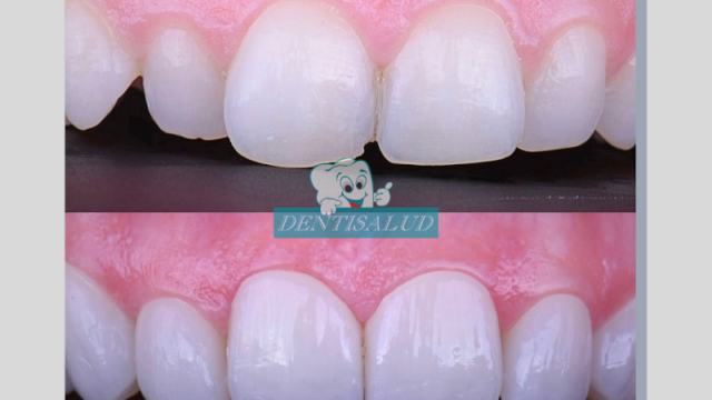 DENTISALUD