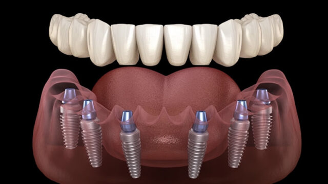 Consultorio Dental Dr Santiago Pichardo