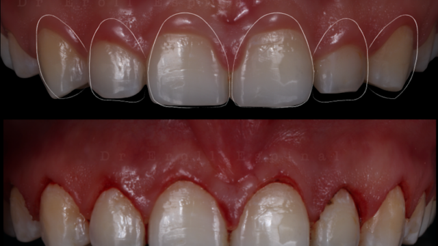 Dr. Eroll Espinal – Odontología Estética